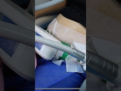 ¿Has probado la congelación de grasa para perder peso?