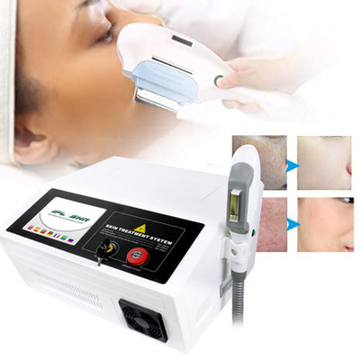 Máquina del laser de la piel del retiro IPL del pelo para el tratamiento de la pigmentación del acné del rejuvenecimiento de la piel