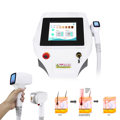 Onda permanente 808nm de Nova Ice Diode Laser Machine 3 del retiro del pelo